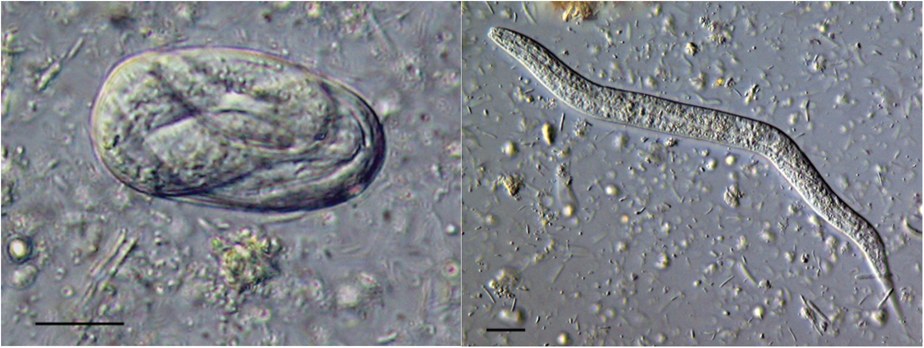 Helminths-strongyloides stercoralis