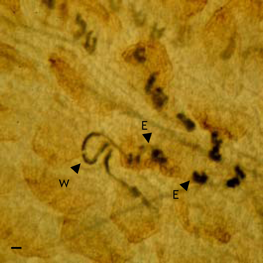 Pinworm baby taxonómia, 15. lecke A puhatestűek és a gyűrűsférgek
