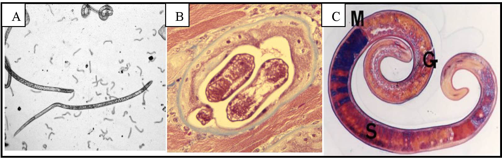 trichinella heterotróf rossz lehelet tüdő tuberkulózissal